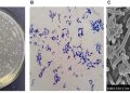 CRISPR e batteri ingegnerizzati contro i tumori freddi