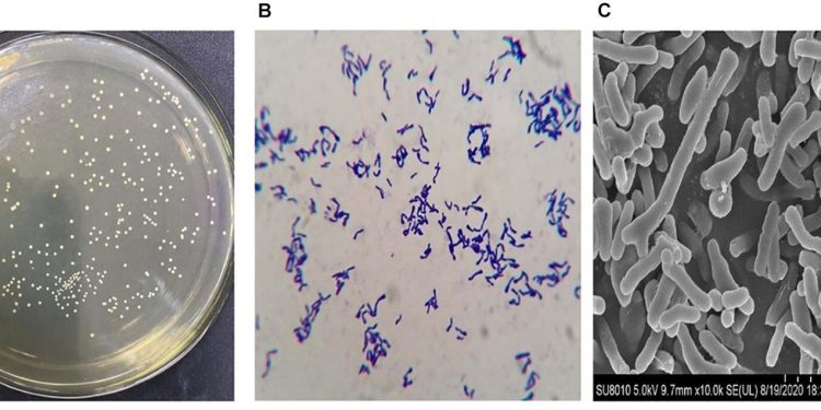 CRISPR e batteri ingegnerizzati contro i tumori freddi