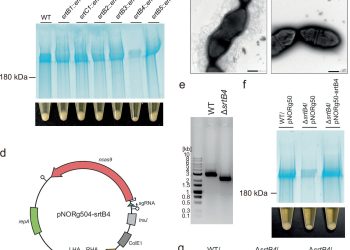 Microbiota: scoperto il rivestimento batterico che frena le infiammazioni