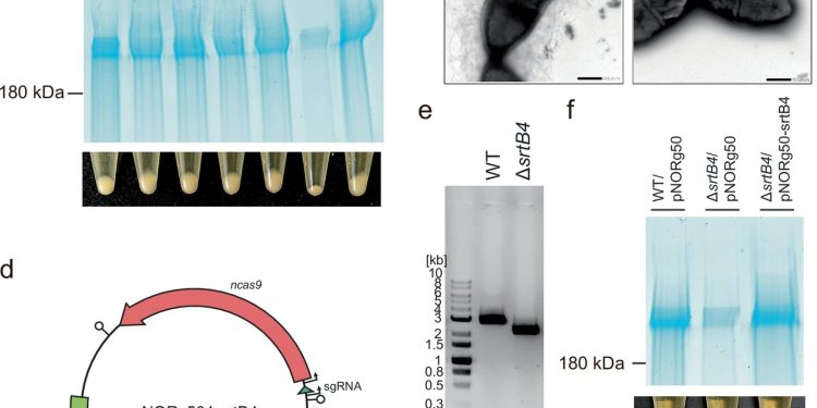 Microbiota: scoperto il rivestimento batterico che frena le infiammazioni