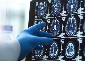 Un farmaco simula l'altitudine per contrastare il Parkinson